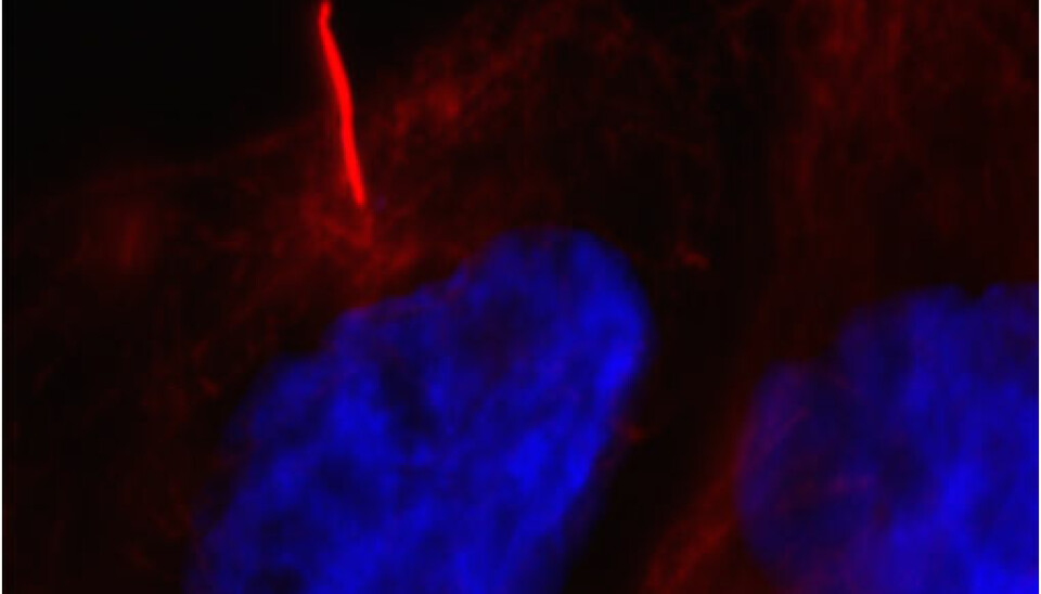 Defects in the cells’ cilia (red line) are the cause of 30 different diseases. Danish basic research aims to map the function of cilia -- research which could lead to effective drugs for the millions of people around the world who suffer from cilia-related diseases (Photo: Lotte Bang Pedersen)