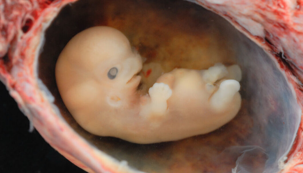 Scientists have yet to figure out what it is that determines whether or not foetal cells survive in the mother’s body. (Photo: Lunar Caustic) Scientists have yet to figure out what it is that determines whether or not foetal cells survive in the mother’s body. (Photo: Lunar Caustic)