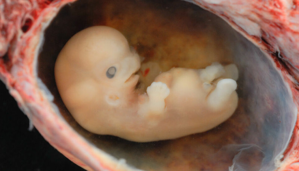 Scientists have yet to figure out what it is that determines whether or not foetal cells survive in the mother’s body. (Photo: Lunar Caustic)