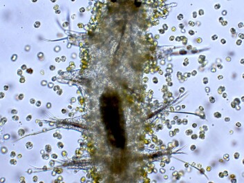 This is what it looks like when the algae attack. Beneath the brown hazy swarm of carnivorous killer algae we glimpse a copepod. (Photo: Terje Berge/International Society for Microbial Ecology Journal) This is what it looks like when the algae attack. Beneath the brown hazy swarm of carnivorous killer algae we glimpse a copepod. (Photo: Terje Berge/International Society for Microbial Ecology Journal)