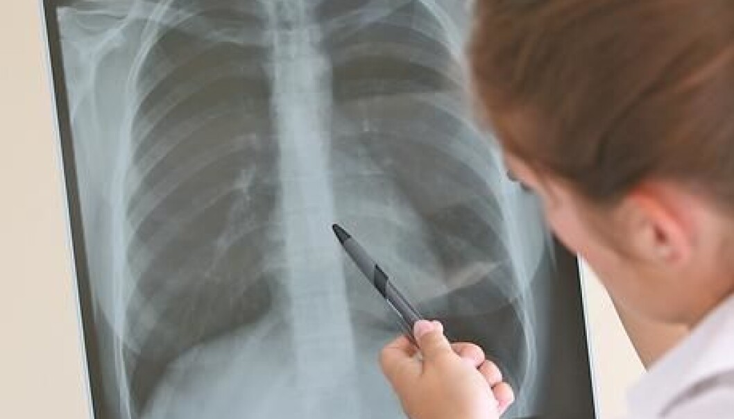 Scientists have found a substance in garlic which could be used to fight the dreaded lung disease cystic fibrosis. The substance, ajoene, breaks down the bacterial communication system, making it easier to kill the bacteria. Ajoene has already proven itself effective against bacteria involved in cystic fibrosis in trial mice. (Photo: Coulourbox) Scientists have found a substance in garlic which could be used to fight the dreaded lung disease cystic fibrosis. The substance, ajoene, breaks down the bacterial communication system, making it easier to kill the bacteria. Ajoene has already proven itself effective against bacteria involved in cystic fibrosis in trial mice. (Photo: Coulourbox)