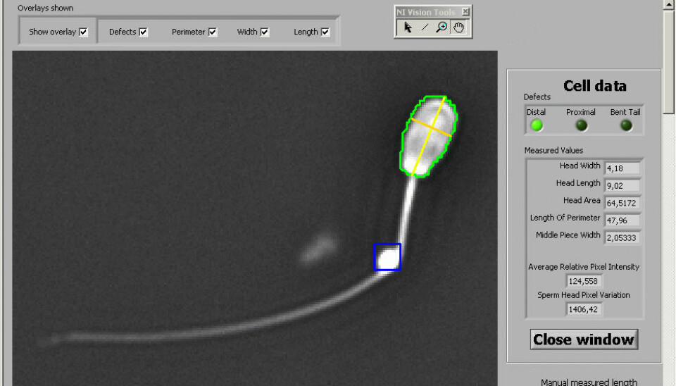 Measuring the length and width of a sperm cell. In the blue box is a distal droplet – an abnormal sperm cell. (Photo: Claus Hansen)