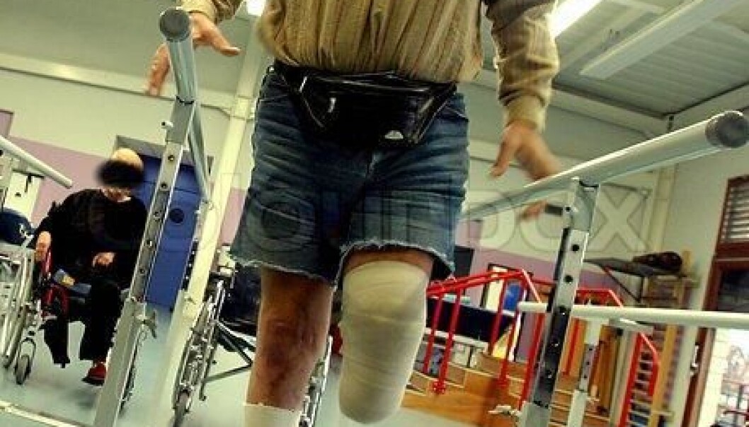 About 70 percent of all amputees experience phantom limb pains. These pains are experienced in many ways. Some patients feel that the amputated limb is still a part of their body and is being crushed in a vice. Others experience very violent pains as strong stabbing or burning feelings. (Photo: Colourbox) About 70 percent of all amputees experience phantom limb pains. These pains are experienced in many ways. Some patients feel that the amputated limb is still a part of their body and is being crushed in a vice. Others experience very violent pains as strong stabbing or burning feelings. (Photo: Colourbox)