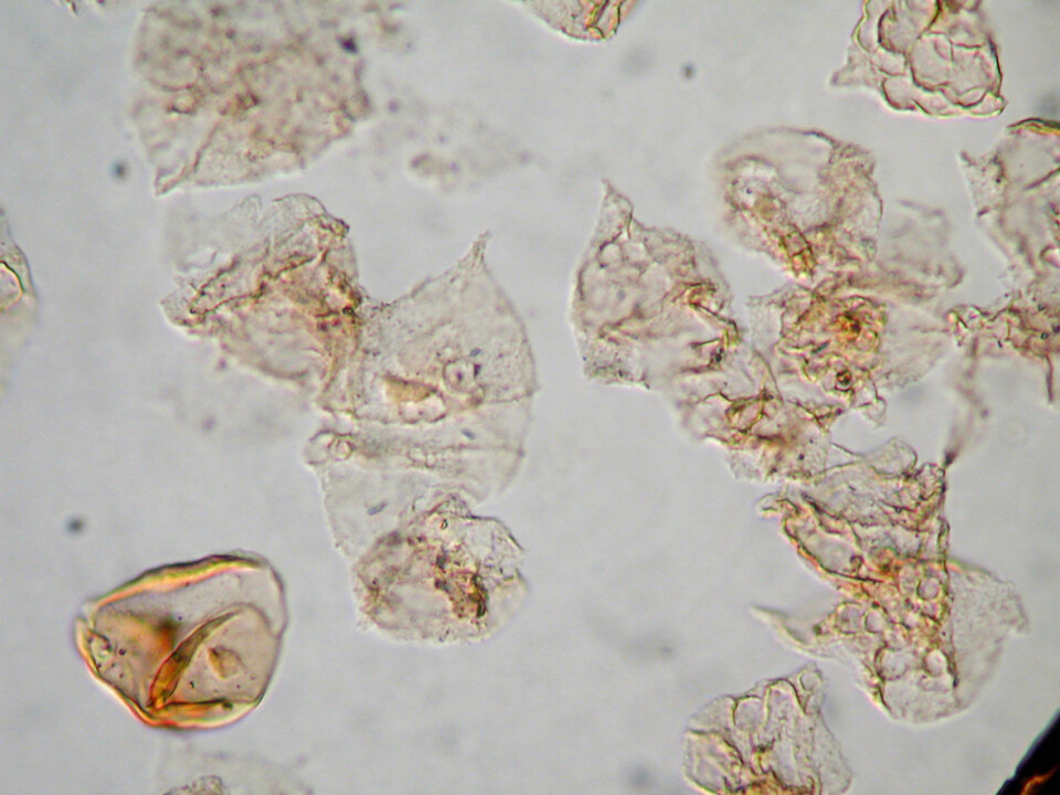 Microscopic photo showing many dinoflagellate cyst fossils (micro-algae), which were common in the ocean before the time in the transition from the Triassic geological period to the Jurassic period when much animal and plant life died, the ‘dead zone’. At lower left is a fern spore, about 40 micrometres in diameter. (Photo: S. Lindström)