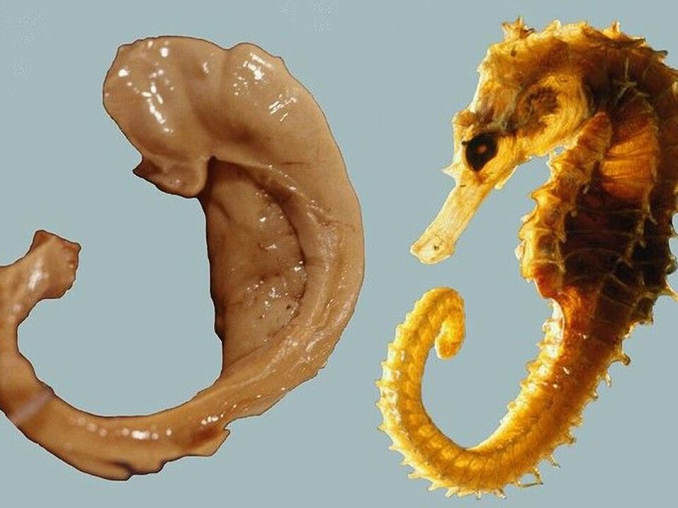 The hippocampus earned its name from its resemblance to a seahorse. (Photo: Laszlo Seress/Wikimedia Commons)