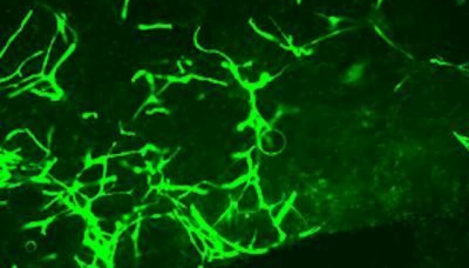 Functional blood vessels formed in vivo in a mouse by transplanted daughter cells of one single adult vascular endothelial stem cell (VESC). (Photo: Salvén Laboratory/University of Helsinki)