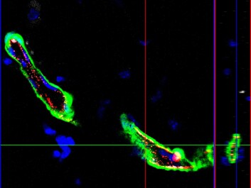 Functional blood vessels grown in vivo form a single transplanted adult vascular endothelial stem cell (VESC). High resolution confocal microscope scanning is used to visualise the cross sections of individual blood vessels. The endtohelial cells are green (genetic GFP-tag) and the nuclei are blue. (Photo: Salvén Laboratory/University of Helsinki) Functional blood vessels grown in vivo form a single transplanted adult vascular endothelial stem cell (VESC). High resolution confocal microscope scanning is used to visualise the cross sections of individual blood vessels. The endtohelial cells are green (genetic GFP-tag) and the nuclei are blue. (Photo: Salvén Laboratory/University of Helsinki)