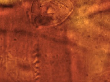 The incredibly well-preserved fossil of a Vorticella. The picture clearly reveals the head with the crescent-shaped nucleus, which contained DNA from the 200 million-year-old animal. For comparison, the picture below is of Vorticellae as they look today. (Photo: Benjamin Bomfleur) The incredibly well-preserved fossil of a Vorticella. The picture clearly reveals the head with the crescent-shaped nucleus, which contained DNA from the 200 million-year-old animal. For comparison, the picture below is of Vorticellae as they look today. (Photo: Benjamin Bomfleur)