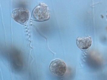 It’s extremely rare for scientists to find fossils of animals that didn’t have hard parts such as bones. Vorticellae dissolve rapidly after dying, which is why they cannot form a fossil under normal circumstances. This picture shows how the unicellular Vorticellae look today. (Photo: Benjamin Bomfleur) It’s extremely rare for scientists to find fossils of animals that didn’t have hard parts such as bones. Vorticellae dissolve rapidly after dying, which is why they cannot form a fossil under normal circumstances. This picture shows how the unicellular Vorticellae look today. (Photo: Benjamin Bomfleur)