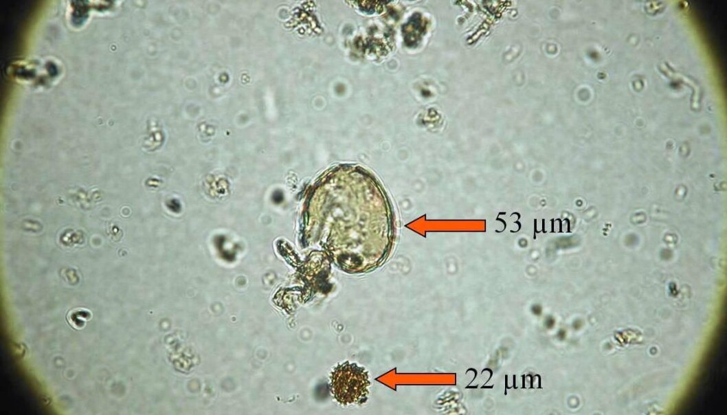 When pollen researchers look into a microscope, they can easily distinguish large pollen grains from other grains, even with as little as 100x magnification. This pollen sample from the Shetlands shows one of the large cereal pollen grains. For comparison, the arrow at the bottom points to a dandelion pollen grain. (Photo: Daniela Richter and Kevin Edwards) When pollen researchers look into a microscope, they can easily distinguish large pollen grains from other grains, even with as little as 100x magnification. This pollen sample from the Shetlands shows one of the large cereal pollen grains. For comparison, the arrow at the bottom points to a dandelion pollen grain. (Photo: Daniela Richter and Kevin Edwards)