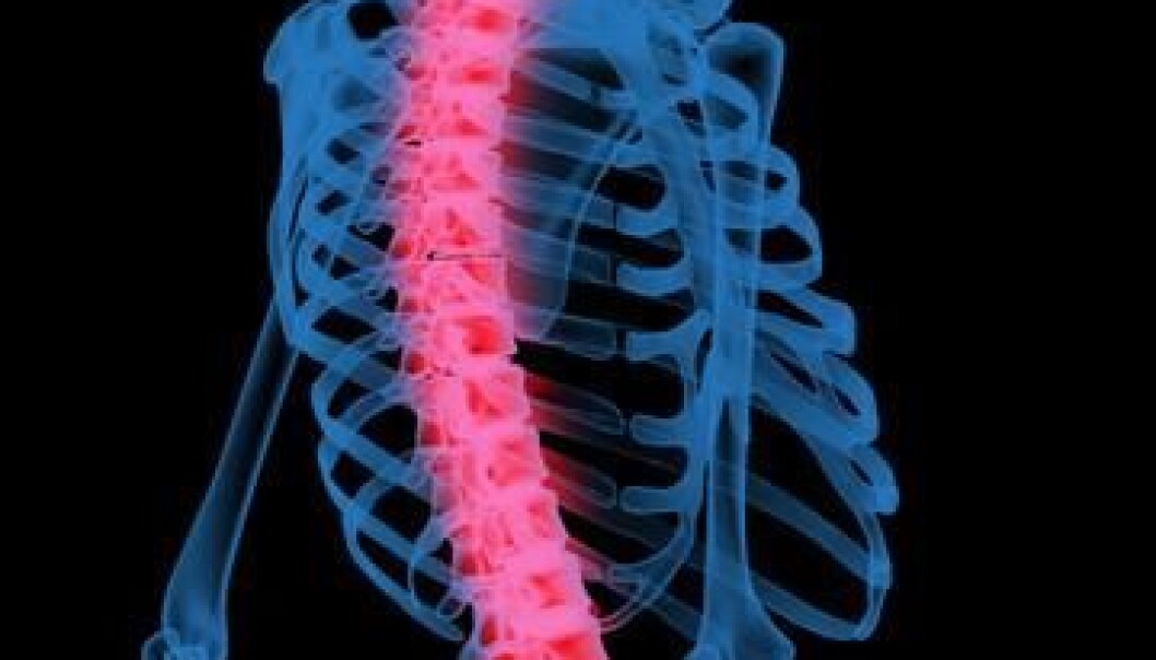 The new substance appears to inhibit the growth of cancers such as bone cancer. (Photo: Colourbox) The new substance appears to inhibit the growth of cancers such as bone cancer. (Photo: Colourbox)