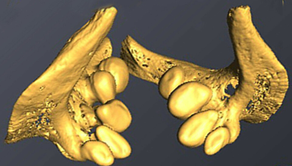 A CT scan of the black carp’s teeth. (Photo: Henry Madsen)