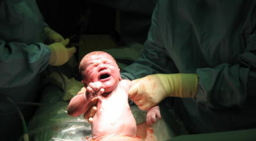 C-section infants don’t get enough good microbes