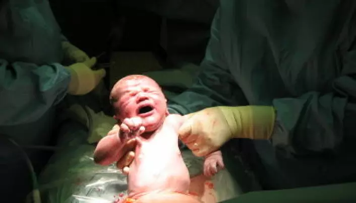 C-section infants don’t get enough good microbes
