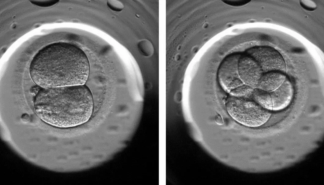 Using time-lapse photos of fertilised eggs in the days before they are inserted into a woman’s uterus, doctors can now spot abnormalities in the eggs. Ideally, an egg would divide from one into two cells and then from two into four, as shown in this photo. If, however, an egg divides directly from one into four cells, the doctors know that there is a very low probability that the egg will result in a pregnancy. (Photo: Kirstine Kirkegaard)