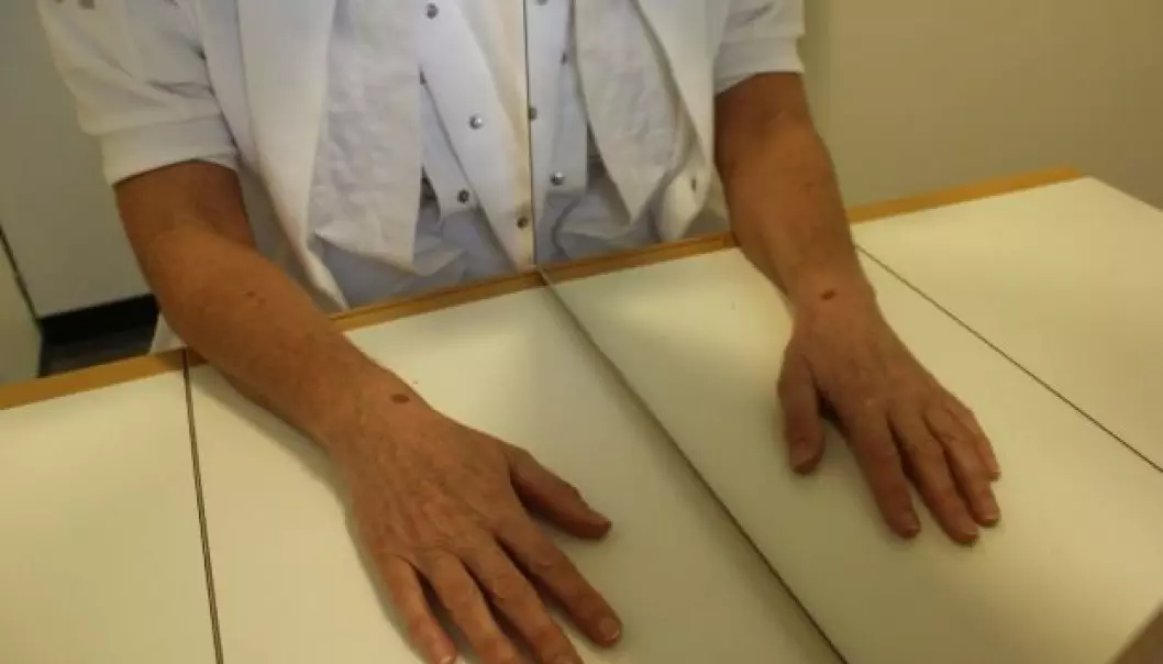 An occupational therapist demonstrates the principle of mirror therapy: the mirror is positioned so that the existing arm is reflected in the mirror. Here, some patients will find that their phantom arm merges with the arm they see in the mirror, and this can relieve the phantom pains. In a new study, researcher Bo Geng aims to further develop this form of treatment, while at the same time stimulating the stump of the amputated limb with tiny electrical shocks. (Photo: Lise Brix)