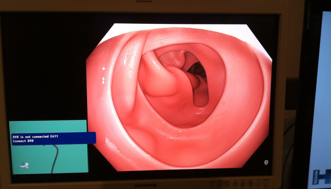 This is what the colon of a dummy looks like (Photo: Marie Brogaard) This is what the colon of a dummy looks like (Photo: Marie Brogaard)