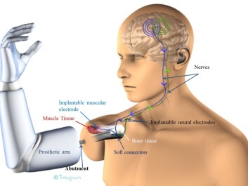 Osseointegration is a term that refers to the connection between living bone and the surface of a load-bearing artificial implant. As the picture shows, the implanted muscle electrodes are linked to nerves that can control the prosthesis. (Photo: the Centre of Orthopaedic Osseointegration, Sweden) Osseointegration is a term that refers to the connection between living bone and the surface of a load-bearing artificial implant. As the picture shows, the implanted muscle electrodes are linked to nerves that can control the prosthesis. (Photo: the Centre of Orthopaedic Osseointegration, Sweden)