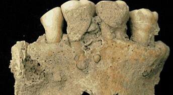Tartar from ancient monks reveals serious diseases