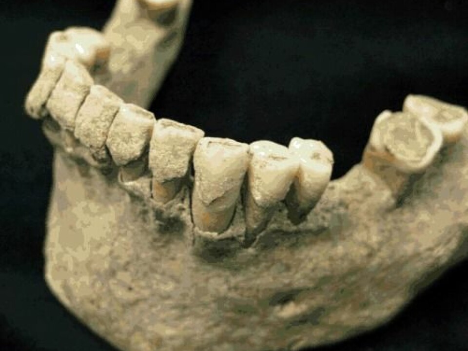 Another set of teeth from a monk. This is the lower jaw. (Photo: Christina Warinner)