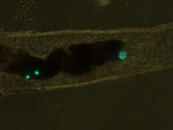 Fluorescent green microplastic spheres as seen inside the intestine of a tiny crustacean, Mysis relicta, after it consumed zooplankton containing the spheres. (Photo: Finnish Environment Institute) Fluorescent green microplastic spheres as seen inside the intestine of a tiny crustacean, Mysis relicta, after it consumed zooplankton containing the spheres. (Photo: Finnish Environment Institute)