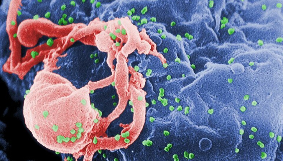 A scan of a HIV-1 virus, which is the most common form of the HIV virus. The green dots show the density of the virus. (Photo: C. Goldsmith)