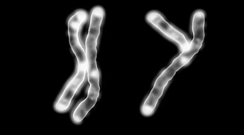 Chromosome Y loss explains men’s shorter longevity