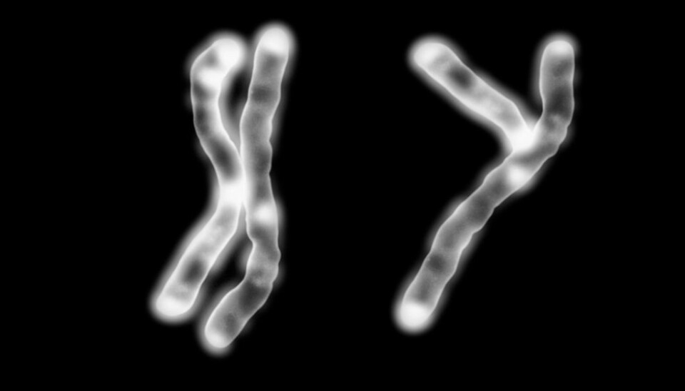 All normal human cells contain 23 pairs of chromosomes, 46 in all. Men and women share 22 of these pairs. But the last chromosome pair among males consists of a chromosome X and a chromosome Y, whereas females have two X chromosomes. The Y chromosome is not really as Y-shaped as in this illustration. (Photo: Science Photo Library/NTB Scanpix)