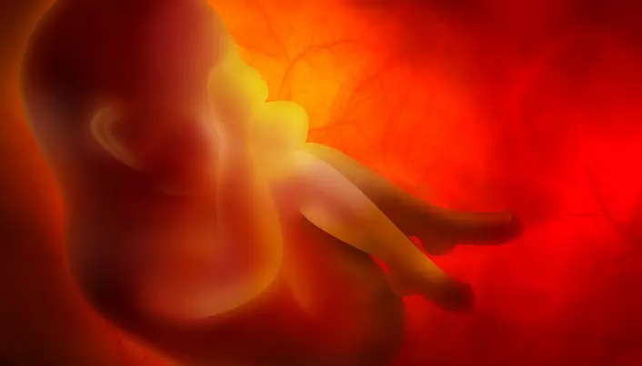 Increased hormone levels in the womb linked to autism