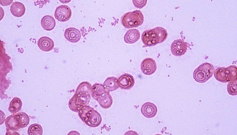 Haemophilus is one of the most common bacteria involved in respiratory infections. (Photo: Besiansejdiu/Wikipedia)