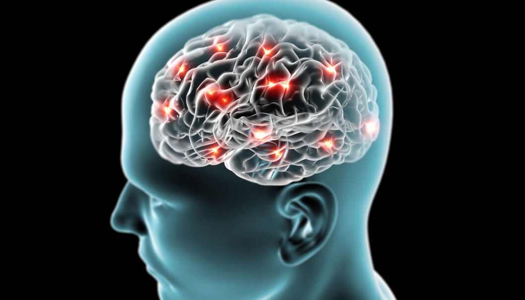 Danish scientists are using computer models to simulate and learn about the progression of Parkinson's disease in the brain. (Photo: <a href=http://www.shutterstock.com/da/pic-159823838/stock-photo-brain-neurons-synapses-reasoning.html?src=DSD0ciCIungVT7W19LFAAg-1-8 target=”_blank”>Shutterstock</a>) Danish scientists are using computer models to simulate and learn about the progression of Parkinson's disease in the brain. (Photo: <a href=http://www.shutterstock.com/da/pic-159823838/stock-photo-brain-neurons-synapses-reasoning.html?src=DSD0ciCIungVT7W19LFAAg-1-8 target=”_blank”>Shutterstock</a>)