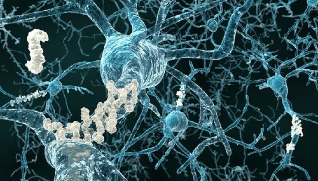 The scientists used a natural mechanism in the body to stop production of amyloid-β. The illustration shows neurons with amyloid plaques.
(Photo: <a href="http://www.shutterstock.com/pic-111506315.html" target="_blank">Shutterstock</a> The scientists used a natural mechanism in the body to stop production of amyloid-β. The illustration shows neurons with amyloid plaques.
(Photo: <a href="http://www.shutterstock.com/pic-111506315.html" target="_blank">Shutterstock</a>