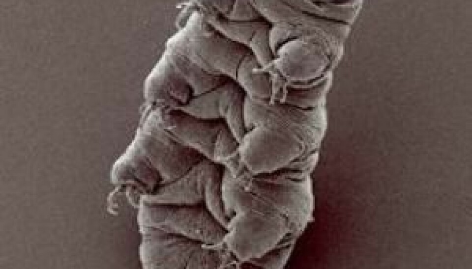 Water bears are minuscule, tough creatures - less than a millimetre long, with eight legs and most reminiscent of a jelly baby. (Foto: Bob Goldstein og Vicky Madden, UNC Chapel Hill)