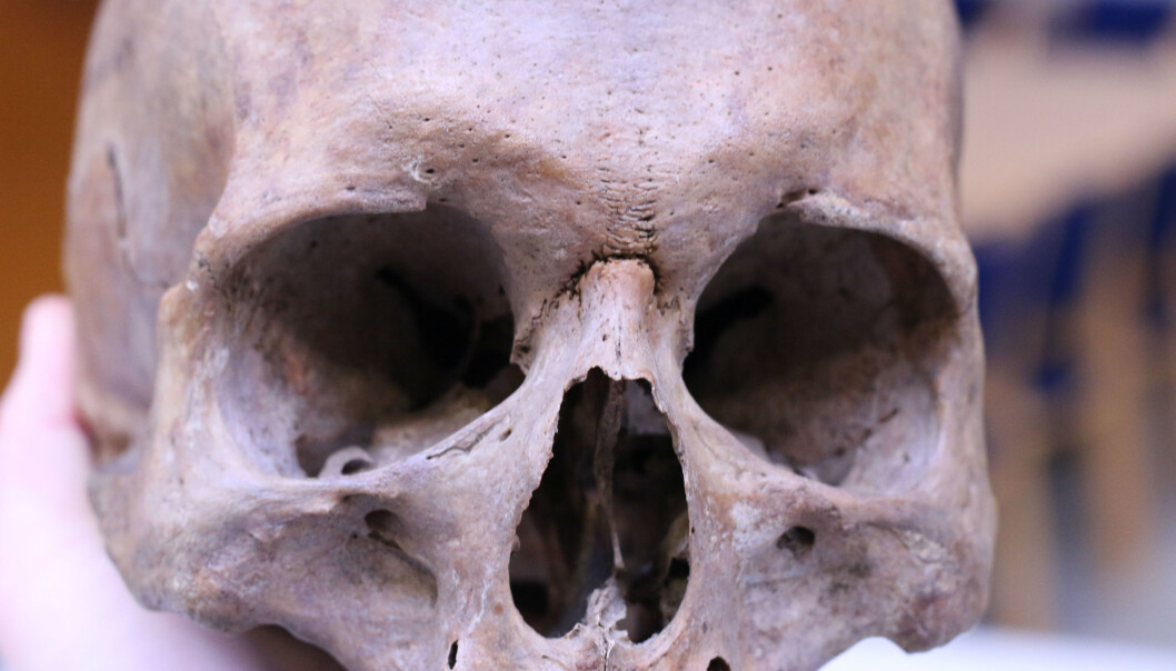 Old skulls like this one from a man who lived in the Middle Ages can tell us something about what life was like back then. (Photo: Marianne Lie Becker, University of Southern Denmark) Old skulls like this one from a man who lived in the Middle Ages can tell us something about what life was like back then. (Photo: Marianne Lie Becker, University of Southern Denmark)