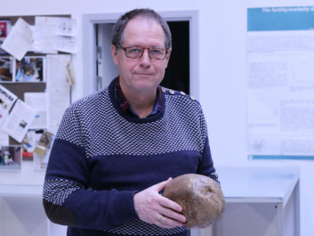 Jesper Lier Boldsen holding the skull of a man who lived with a skull fracture until it healed of its own. (Photo: Marianne Lie Becker, University of Southern Denmark) Jesper Lier Boldsen holding the skull of a man who lived with a skull fracture until it healed of its own. (Photo: Marianne Lie Becker, University of Southern Denmark)