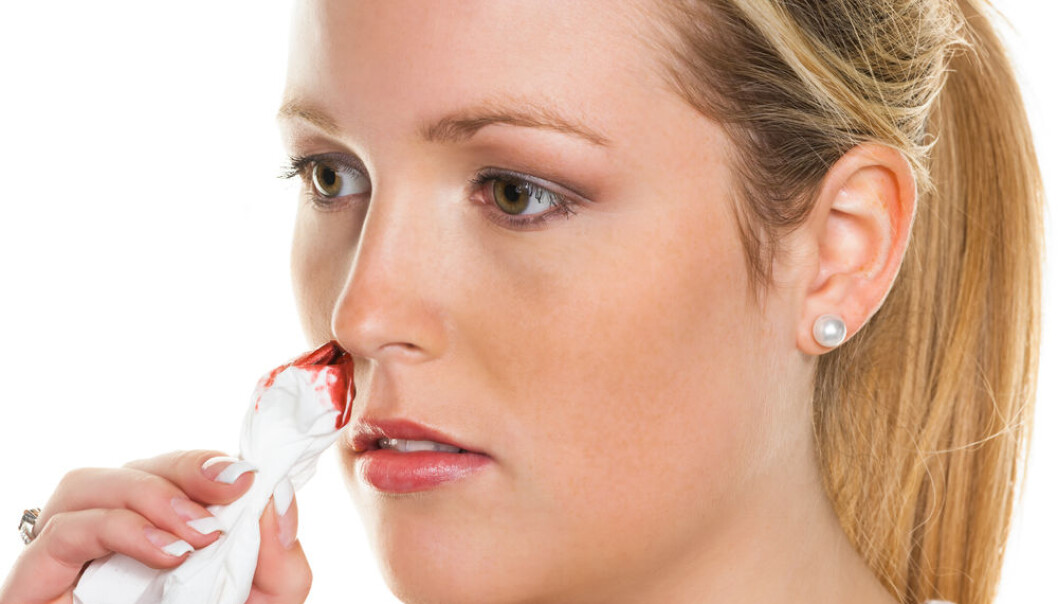 The body produces antibodies against the medicine which can help people with haemophilia. New research shows how the immune system can be duped into believing that the medicine belongs in the body. (Photo: Shutterstock) The body produces antibodies against the medicine which can help people with haemophilia. New research shows how the immune system can be duped into believing that the medicine belongs in the body. (Photo: Shutterstock)