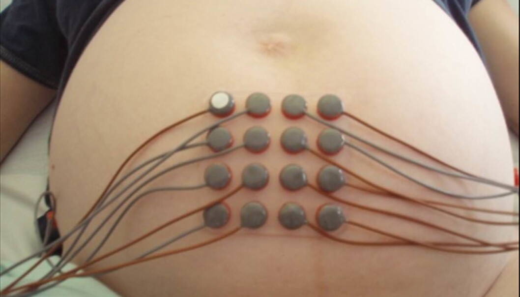 Instead of measuring signals from one or two isolated places on the abdomen, the Icelandic team uses a matrix of electrodes. (Photo: Brynjar Karlsson) Instead of measuring signals from one or two isolated places on the abdomen, the Icelandic team uses a matrix of electrodes. (Photo: Brynjar Karlsson)