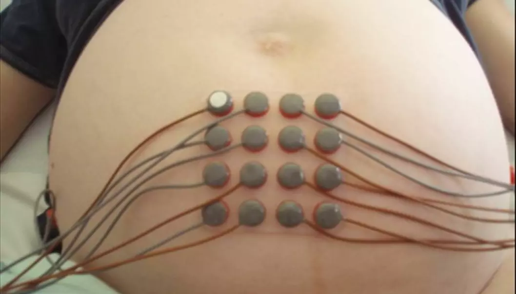 Instead of measuring signals from one or two isolated places on the abdomen, the Icelandic team uses a matrix of electrodes. (Photo: Brynjar Karlsson)