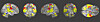 smartapp brain