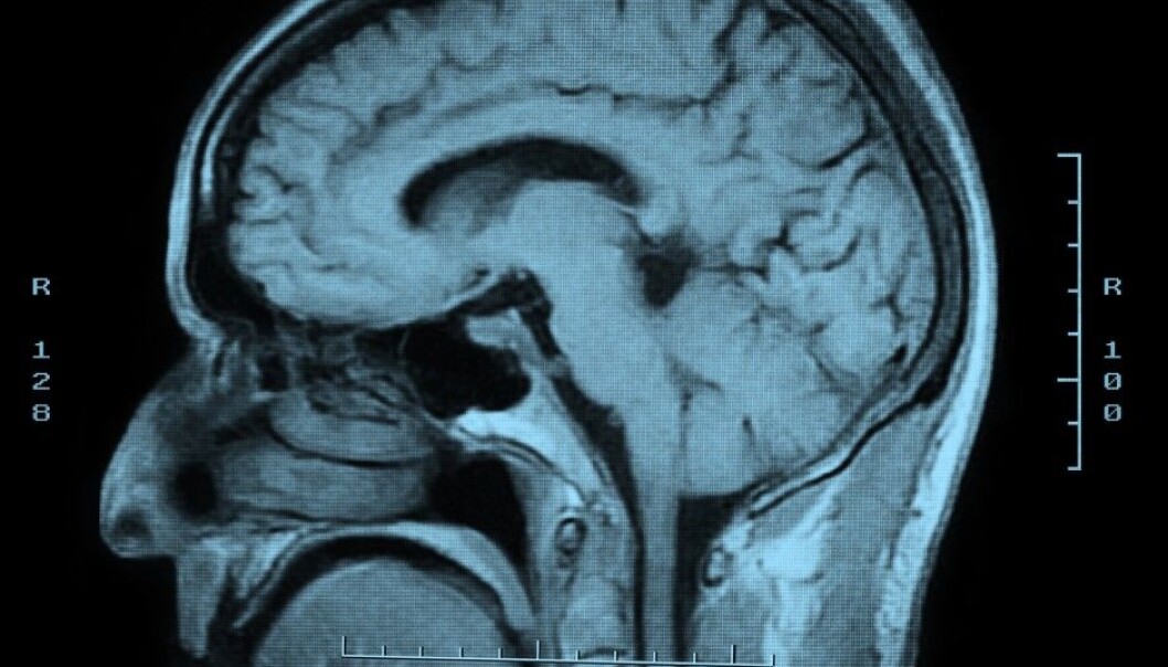 The neurons that say “no”, D2R, normally dominate the basal ganglia. They play a key role when we make decisions. (Photo: Microstock) The neurons that say “no”, D2R, normally dominate the basal ganglia. They play a key role when we make decisions. (Photo: Microstock)