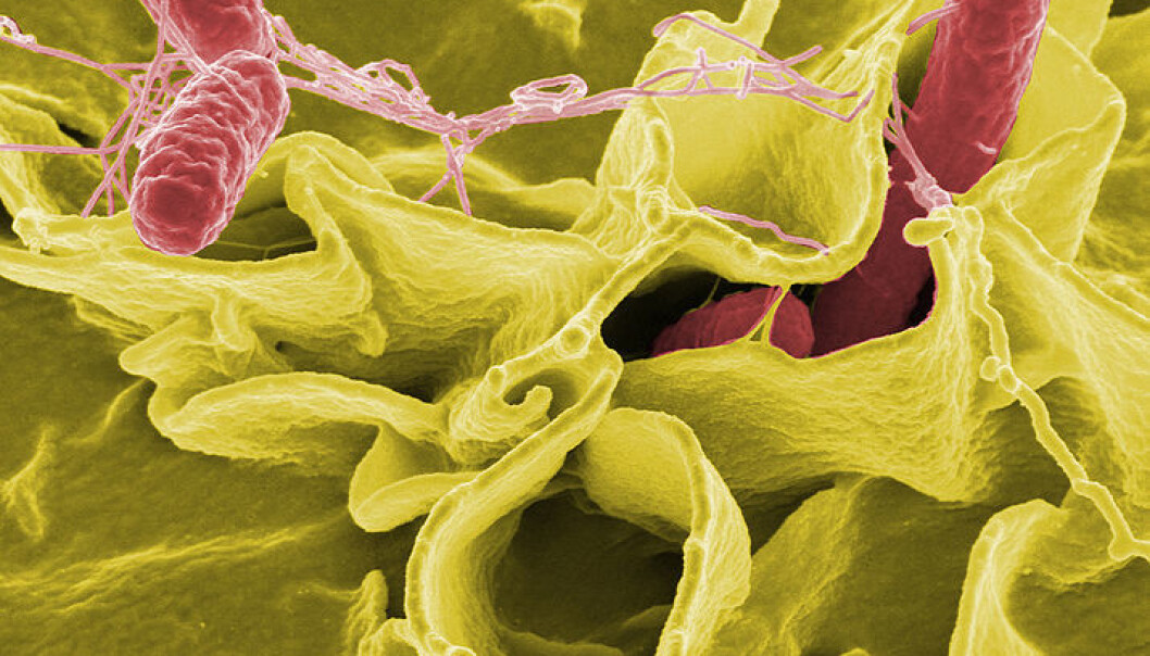 Color-enhanced scanning electron micrograph showing Salmonella Typhimurium (red) invading cultured human cells. (Photo: National Institutes of Health, USA, via Wikimedia Commons) Color-enhanced scanning electron micrograph showing Salmonella Typhimurium (red) invading cultured human cells. (Photo: National Institutes of Health, USA, via Wikimedia Commons)