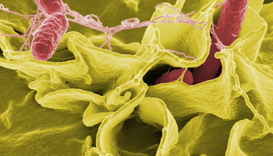 Color-enhanced scanning electron micrograph showing Salmonella Typhimurium (red) invading cultured human cells. (Photo: National Institutes of Health, USA, via Wikimedia Commons)