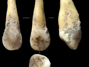 Scientists analysed DNA from ancient human teeth found at archaeological sites around Spain. These 7,400-year-old teeth were found in Vallirana, near Barcelona, and were analysed by Hannes Schroeder and his colleagues. (Photo: Joan Daura/Montserrat Sanz) Scientists analysed DNA from ancient human teeth found at archaeological sites around Spain. These 7,400-year-old teeth were found in Vallirana, near Barcelona, and were analysed by Hannes Schroeder and his colleagues. (Photo: Joan Daura/Montserrat Sanz)