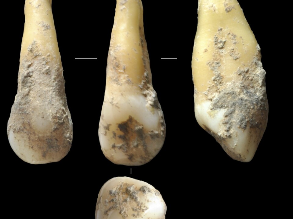 Scientists analysed DNA from ancient human teeth found at archaeological sites around Spain. These 7,400-year-old teeth were found in Vallirana, near Barcelona, and were analysed by Hannes Schroeder and his colleagues. (Photo: Joan Daura/Montserrat Sanz)