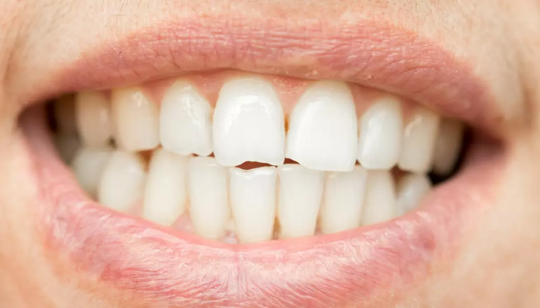 Our teeth do not produce enamel, but contain proteins that act as a scaffold for the mineral enamel. These proteins have a shared evolutionary origin with fish scales. (Photo: Shutterstock)