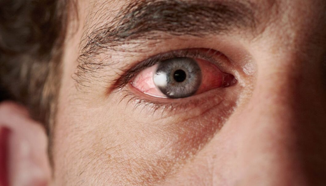 Less than seven hours of sleep every night can cause your cells to age prematurely by upwards of ten years shows new research. (Photo: <a href=http://www.shutterstock.com/pic-126608381.html target="blank_">Shutterstock</a>) Less than seven hours of sleep every night can cause your cells to age prematurely by upwards of ten years shows new research. (Photo: <a href=http://www.shutterstock.com/pic-126608381.html target="blank_">Shutterstock</a>)