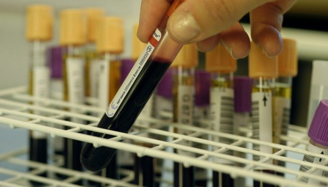 Scientists have calculated how much biologically older we get if we habitually drinking lots of sugary sodas – and how much younger we might remain by drinking moderate amounts of coffee. This was done by measuring nearly 80 blood plasma proteins which indicate fast or slow biological ageing. The test they contrived has not been readied yet for the market, but the researchers think it will eventually become available. (Photo: Shutterstock) Scientists have calculated how much biologically older we get if we habitually drinking lots of sugary sodas – and how much younger we might remain by drinking moderate amounts of coffee. This was done by measuring nearly 80 blood plasma proteins which indicate fast or slow biological ageing. The test they contrived has not been readied yet for the market, but the researchers think it will eventually become available. (Photo: Shutterstock)