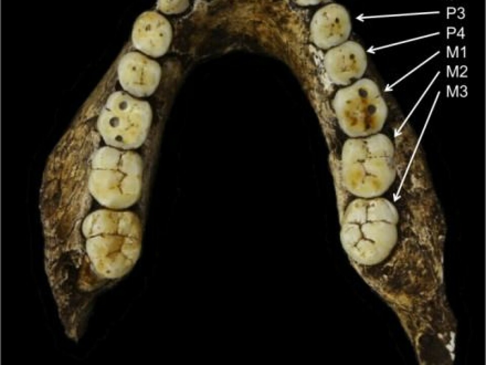 Our early ancestors had very different teeth. Early African ancestors that predate the Homo genus had molars that generally increased in size further back along the jaw. In the Homo genus, this pattern switches, so that the first molar tooth (M1) became the largest, with the teeth on either side gradually becoming smaller. In the photo, P3 and P4 stand for premolar, C refers to canine teeth and M refers to molar teeth. (Photo: lawnchairanthropology)