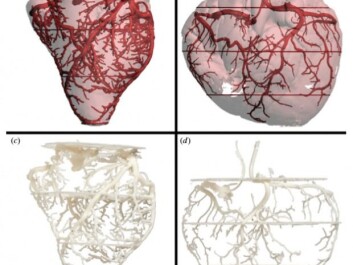 An example plastic 3D-print out of complex structures. On the left is a giraffe heart arterial wire mesh, and to the right is the same from an African elephant. (Photo: Aarhus University) An example plastic 3D-print out of complex structures. On the left is a giraffe heart arterial wire mesh, and to the right is the same from an African elephant. (Photo: Aarhus University)