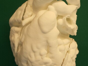 The scientists behind the new study have also produced 3D-models of child and adult hearts to help plan for surgery on complex heart defects. This model opens on each side to enable surgeons to peek inside. (Photo: Henrik Lauridsen) The scientists behind the new study have also produced 3D-models of child and adult hearts to help plan for surgery on complex heart defects. This model opens on each side to enable surgeons to peek inside. (Photo: Henrik Lauridsen)